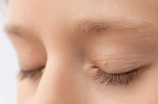 Understanding Eyelid Tags: A Brief Overview by London Dermatology Clin