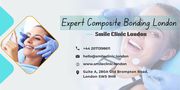 Expert Composite Bonding London - Smile Clinic London